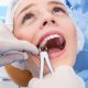 جراحی کشیدن دندان عقل