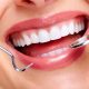 روش های دندانپزشکی زیبایی