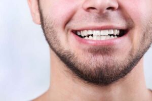 ایمپلنت و مشکل بایت دندان