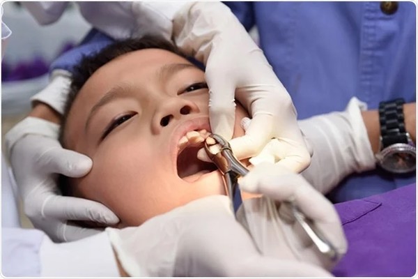 عوارض بعد از کشیدن دندان