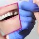 بریج دندان چه فرقی با ایمپلنت دندان دارد؟