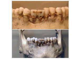 دندانپزشکی زیبایی از زمان های گذشته !