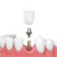 علل موارد اضطراری دندانپزشکی چیست؟