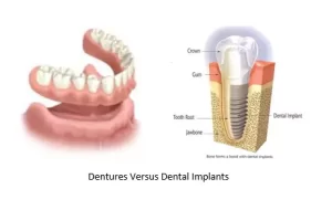 پروتز دندان 