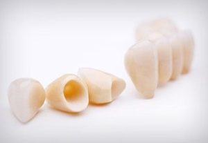چرا باید ترمیم های دندانی بدون فلز را انتخاب کنید؟