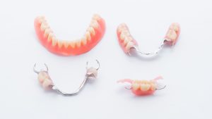 زمان جایگزینی پروتزهای دندان مصنوعی